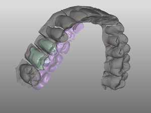 Computer Assisted Design