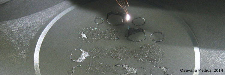 CAM - Selective Laser Melting