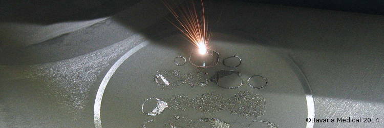 CAM - Selective Laser Melting