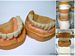 maxillary and mandibular fixed dental prosthetic (CoCr-slm + d'Sign ceramic)