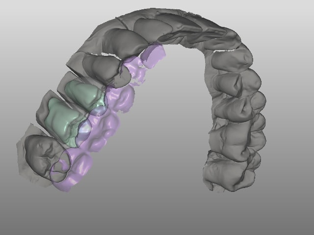 3D Scanning