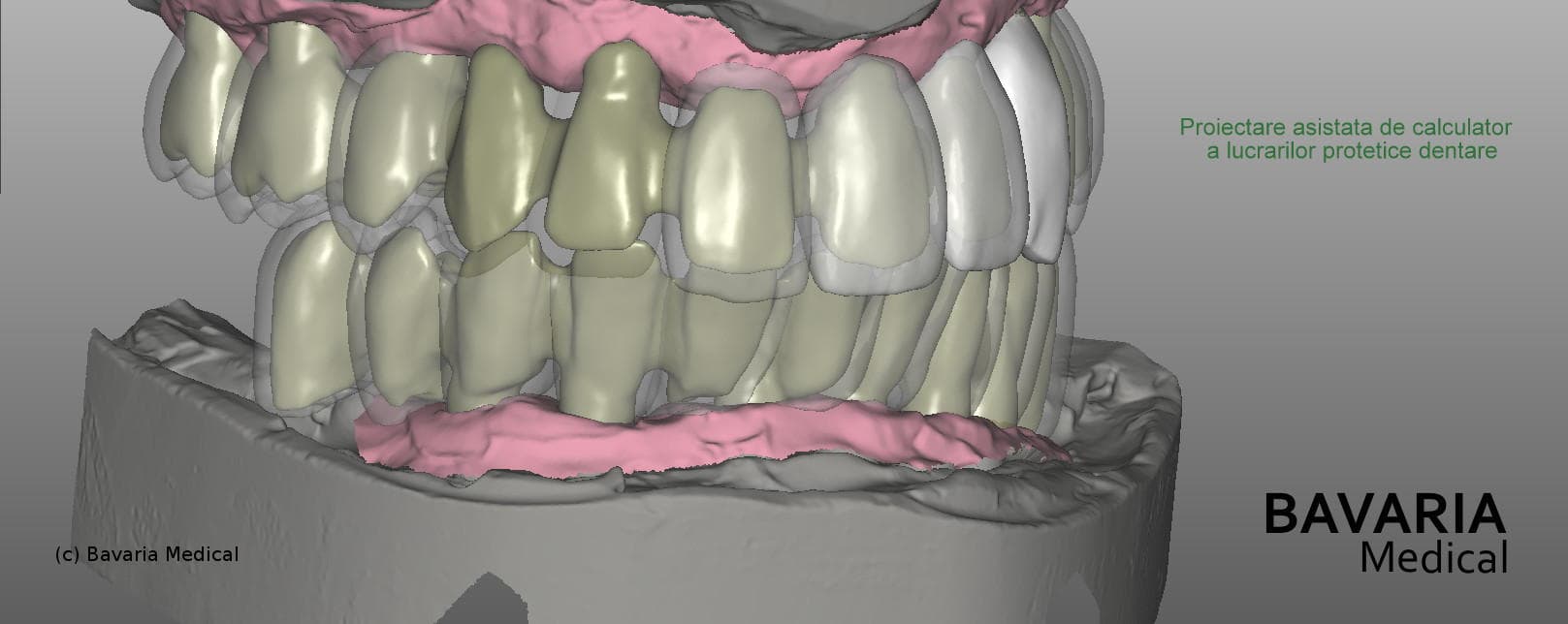 dental computer assisted design